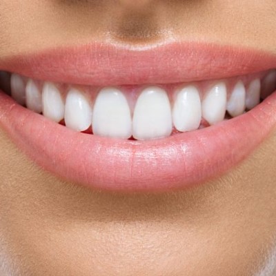 What You Can Do to Improve Your Smile