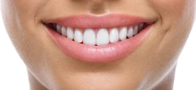 What You Can Do to Improve Your Smile
